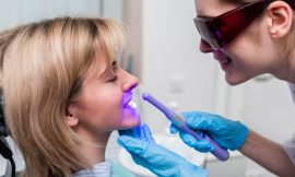 Clareamento dental: Conheça todos os benefícios