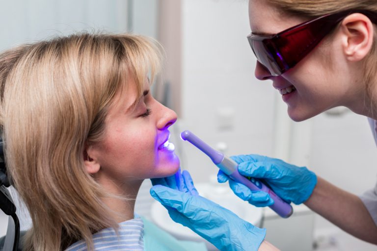 Leia mais sobre o artigo Clareamento dental: Conheça todos os benefícios