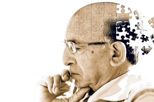 Read more about the article O que é Alzheimer: Tudo o que você precisa saber