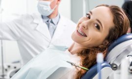 Aparelhos dentários: quais os tipos e indicações de uso?