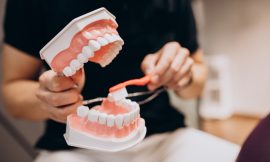 Qual é a melhor opção: prótese ou implante dentário?